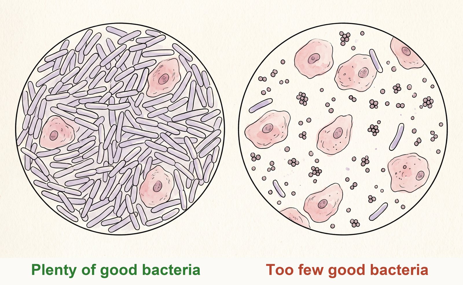 Illustration of two microscope views: many long rod-shaped good bacteria on the left, far fewer on the right